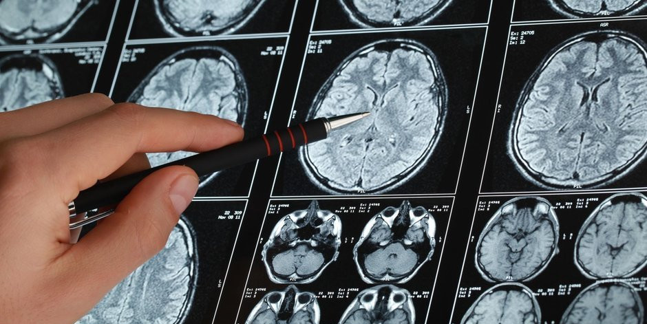 O hastaların yüzde 30’u üfürükçüden medet umuyor!