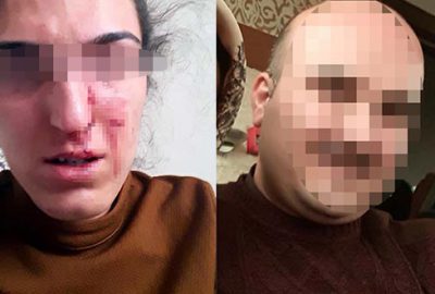 Eşinden şiddet gören öğretmen: Öldürmesi mi gerekiyor?