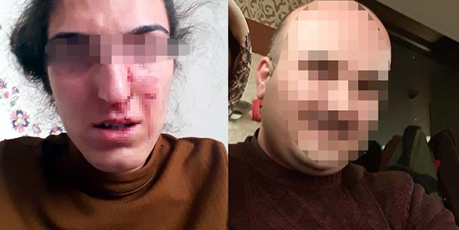 Eşinden şiddet gören öğretmen: Öldürmesi mi gerekiyor?