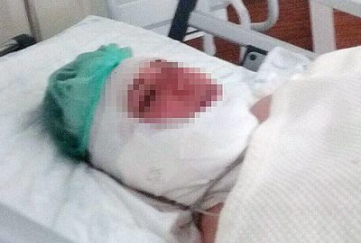 Kocasının elinden ölü numarası yaparak kurtuldu