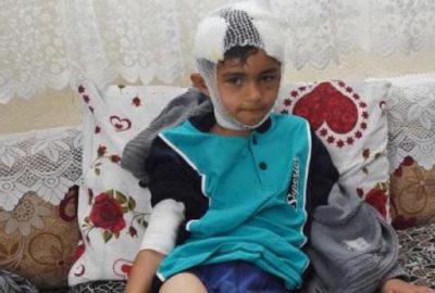 Sokak köpeklerinin elinden son anda kurtarıldı