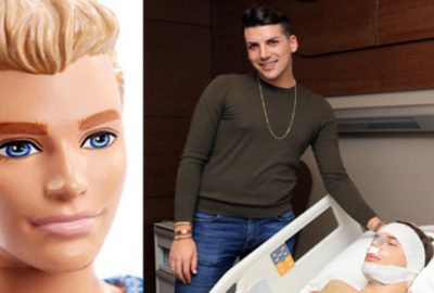 Oyuncak bebeğe benzemek için 6 kez ameliyat oldu! İşte son hali