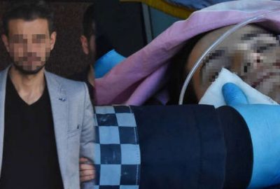 Eşinin yüzüne ‘çarpı işareti’ çizen kocadan mahkemede şok hamle!