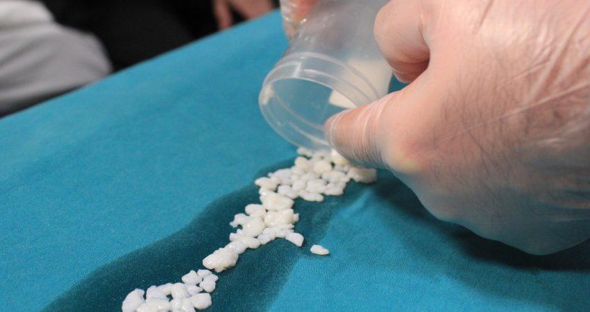 Konya'da diz ağrısı şikayetiyle gittiği hastanede ameliyata alınan Neriman Uzbaş'ın