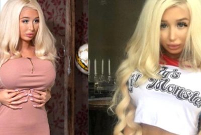 Estetiksiz halini gören ‘Keşke doğal kalsaydın’ diyor