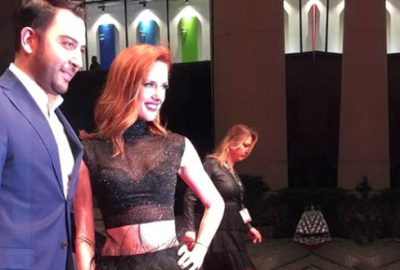 ‘Bacaklarımı tıraş etmeyi unuttum’ diye gaf yapınca kocası şoke oldu