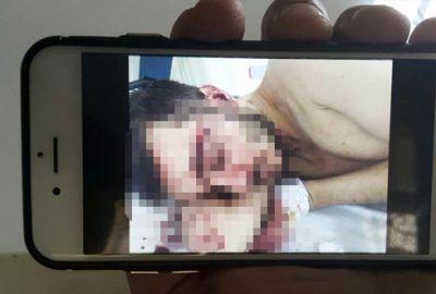 İnternetten tanışıp buluştular, sonrası dehşet!