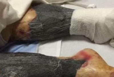 Dikkat sizin de başınıza gelebilir… Pişirmeden yedi, sonrası dehşet!