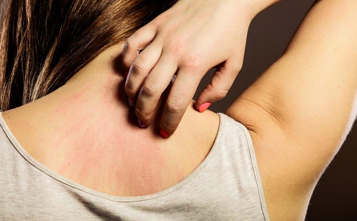 Acıbadem Kozyatağı Hastanesi Dermatoloji Uzmanı Prof. Dr. İkbal Esen Aydıngöz