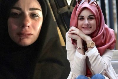 Sosyal medya fenomeni Elif Kübra Genç, saldırıya uğradı!
