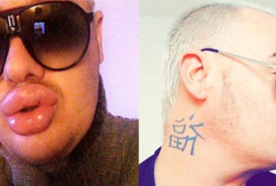 Estetik faciası! Eski halini gören şoke oluyor