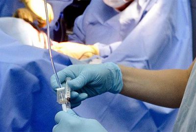 Gizlice karısının böbreğini satmış!