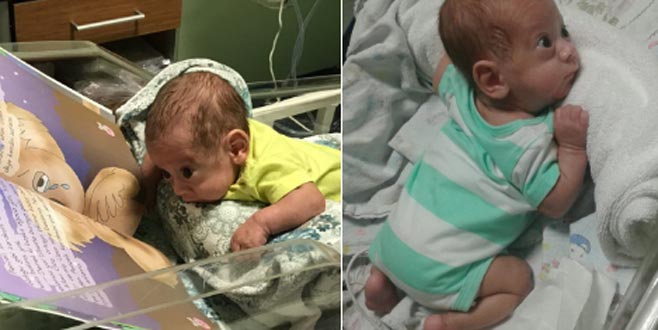 600 gram doğdu! Hayata tutundu…