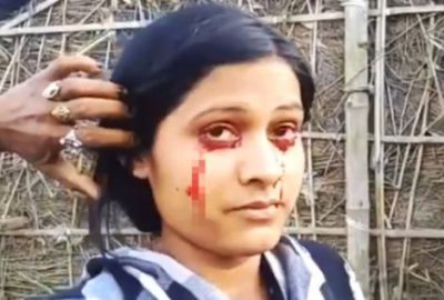 Kan ağladığı için kocası terk etti!