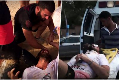 Survivor Hakan görme sorunu yaşayabilir!