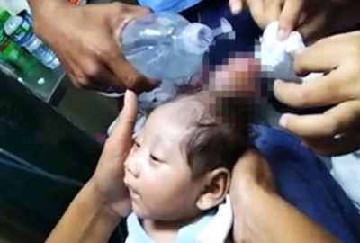 Boynuzlu bebek tıp tarihine geçti!