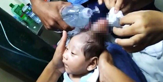 Boynuzlu bebek tıp tarihine geçti!