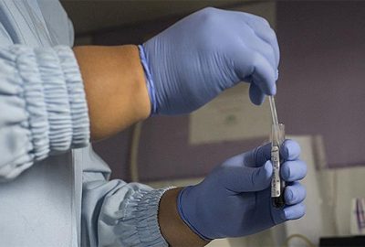 Eski Rus casusun kanında bilinmeyen bir madde bulundu