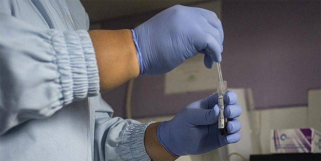 Eski Rus casusun kanında bilinmeyen bir madde bulundu