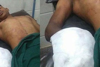 Cinsel içerik bağımlısı oğlunun elini kopardı