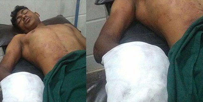 Cinsel içerik bağımlısı oğlunun elini kopardı Cinsel içerik bağımlısı oğlunun elini kopardı