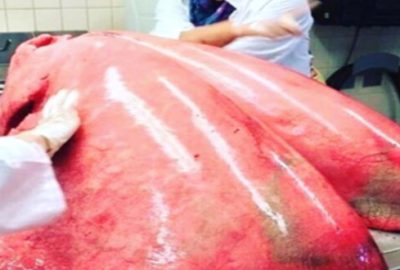 Akciğer olduğunu duyan şaşıp kalıyor!