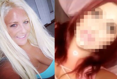 Estetiğe 50 bin dolar harcadı! Görenler inanamadı…