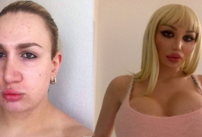 Kadın olmak için 16 kez bıçak altına yattı! İşte son hali..