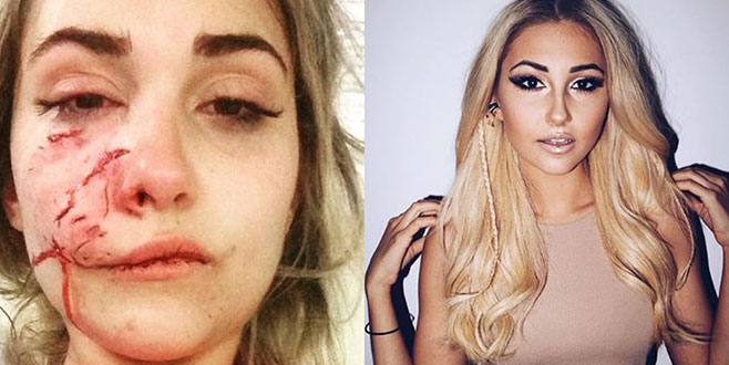 Ünlü model sevmek istediği köpeğin saldırısına uğradı!