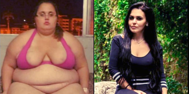 Obeziteden ölmek üzereydi, 94 kilo verip fenomen oldu