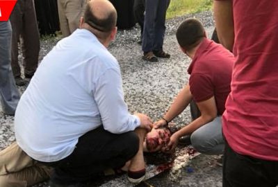 ‘Kaplumbağa ölmesin’ diye mücadele verirken kendisi ölüyordu