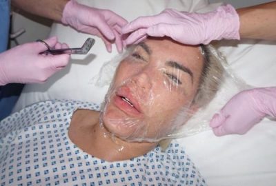 Doktorların uyarılarını dinlemedi! Son hali korkuttu