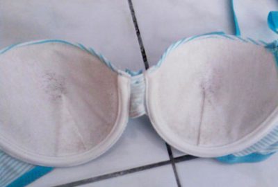 Pazardan aldığı sütyen, göğsünü böcek yuvasına dönüştürdü