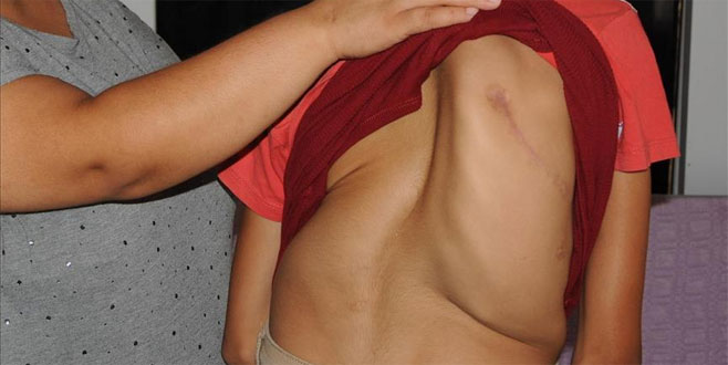 En çok kız çocuklarında görülüyor! Bu belirtilere dikkat! En çok kız çocuklarında görülüyor! Bu belirtilere dikkat!