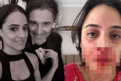 Ünlü oyuncu nişanlısını bu hale getirdi!