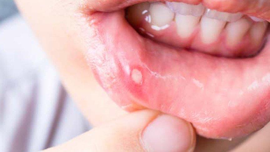 2 adımda iyileştirebilirsiniz!