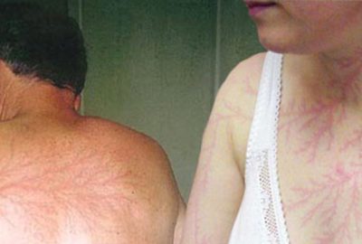 Dikkat aynısı sizin de başınıza gelebilir!