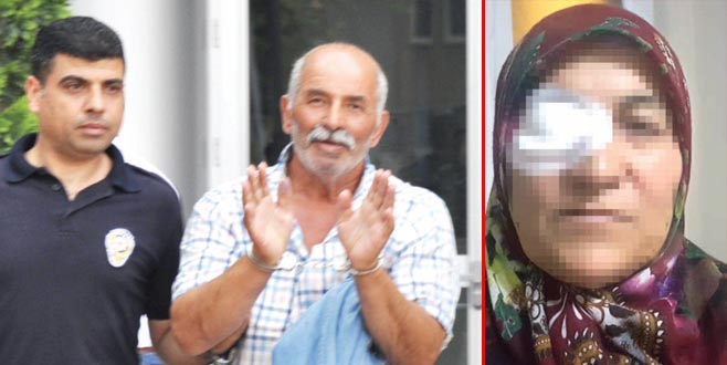 Bursa’da koca dehşeti: Eşinin yüzüne…