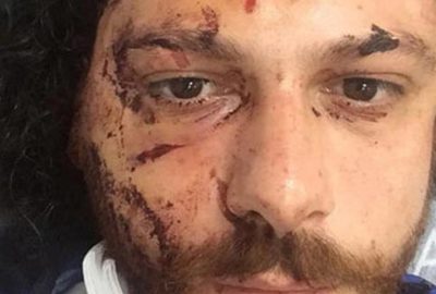 Kadıköy’de oyuncuya şok saldırı! Canını zor kurtardı