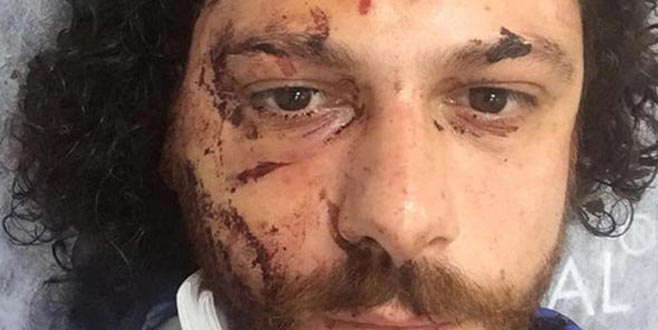 Kadıköy’de oyuncuya şok saldırı! Canını zor kurtardı