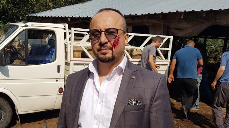 İcra takibi yapan avukatı yanağından ısırdı