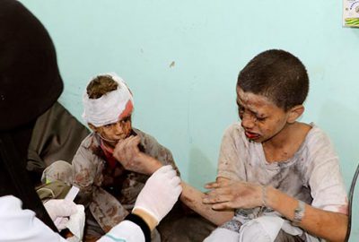 Yemen’de çocukları taşıyan otobüse saldırı