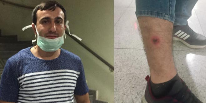 İstanbul’da şarbona yakalananlardan biri konuştu: Eti yemedim, temas ettim