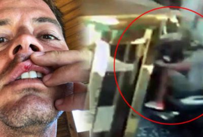 Alp Kırşan’ın zor anları! Sevenlerini korkuttu