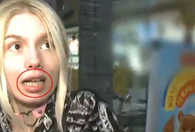 Aleyna Tilki’nin dişleri, sosyal medyada alay konusu oldu