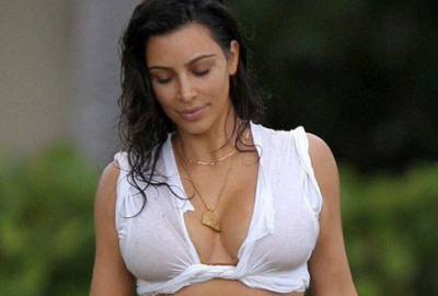 Aşırı estetikten yüzünü kaybetti!