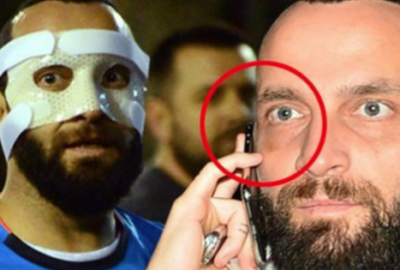 Berkay korkuttu! Olay sonrası…