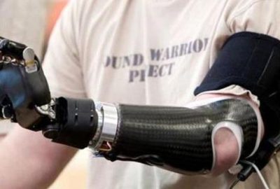 Filmlerde rol alabilmek için kolunu kesti!