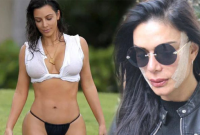 Kim Kardashian’a benzemek için şimdi de…
