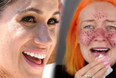 Meghan Markle gibi olayım derken bambaşka birine dönüştü!